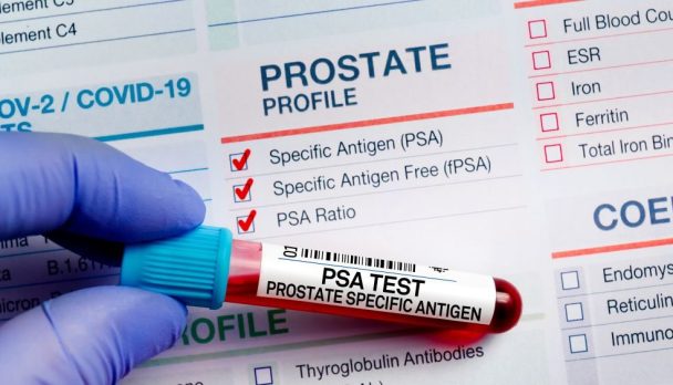 PSA testing course image